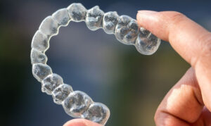 invisalign clear aligners