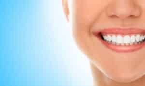 Teeth Whitening In Advanced Dental Center - Lincoln Park MI