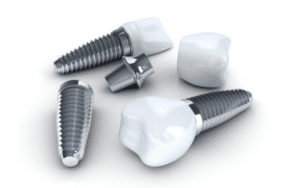 choosing the right solution for your missing tooth