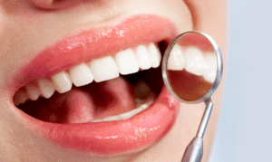 Popular Cosmetic Dentistry Procedures
