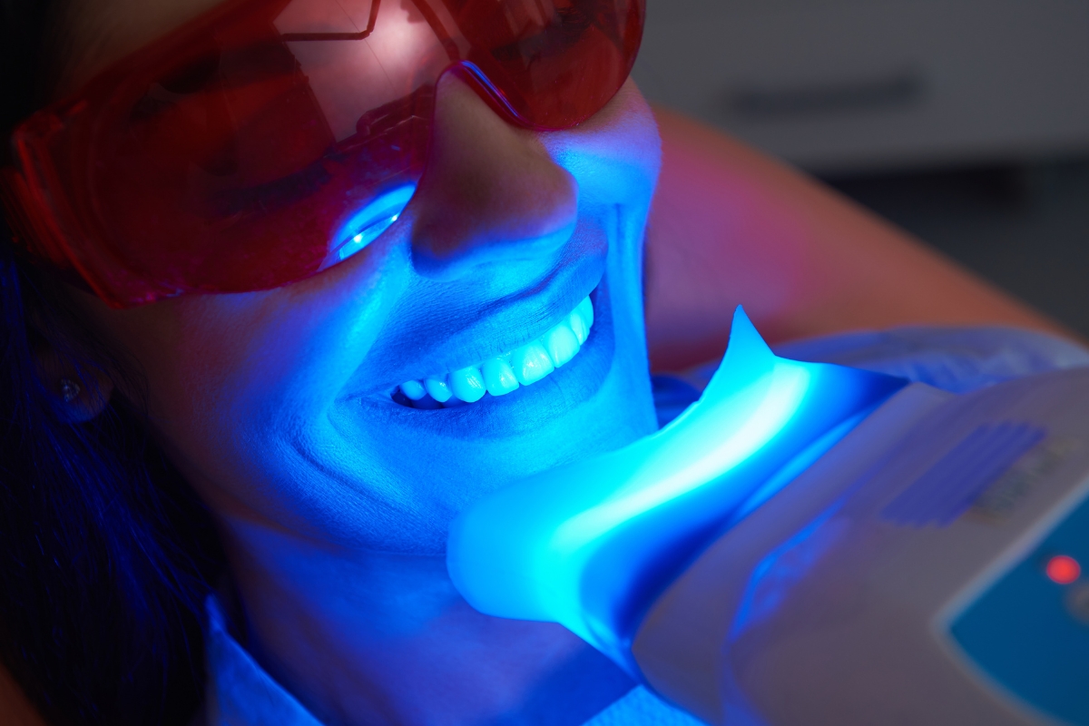 Teeth-Whitening-in-Lincoln-Park-MI