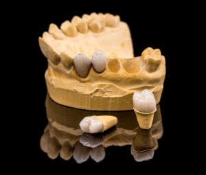 Dental Crowns in Lincoln Park